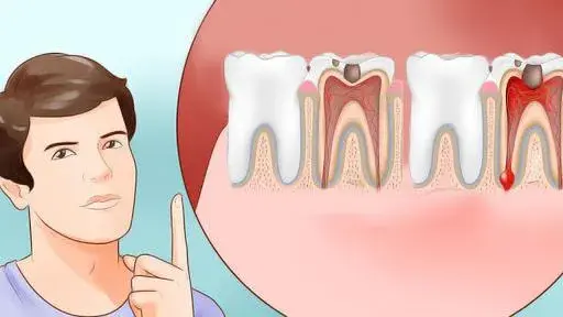 Ból zęba? Jak szybko poczuć ulgę i kiedy pilnie do dentysty.