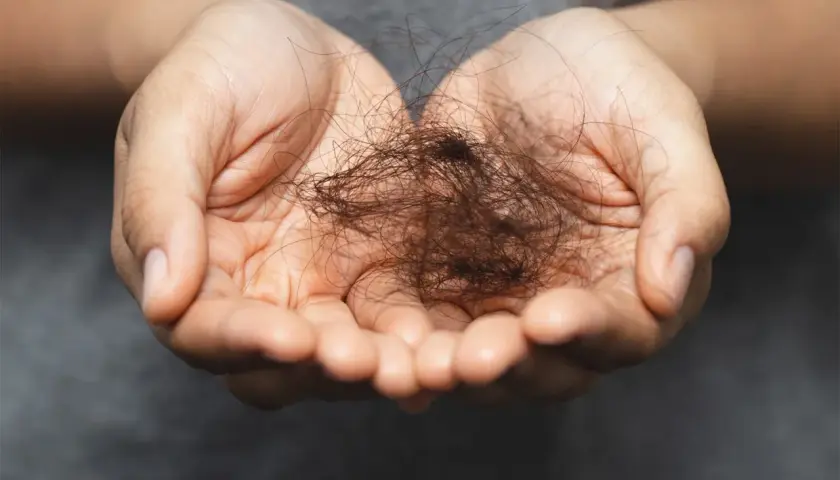 Manos sostienen un puñado de cabello suelto, un signo visible de efluvio telógeno crónico.