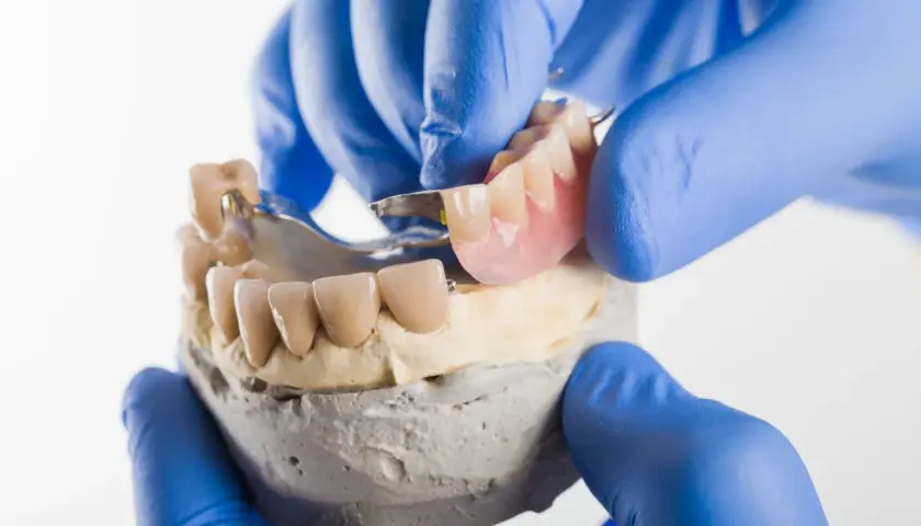 Dentyści prezentują protezę szkieletową na modelu. Poznaj atrakcyjną proteza szkieletowa cena.