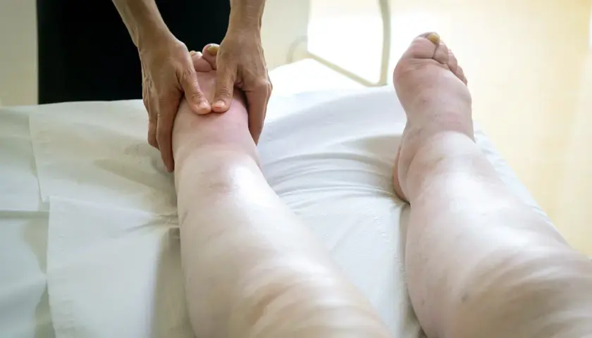 Masaż stóp i nóg z obrzękami, które przypominają malar bags. Terapeuta delikatnie uciska stopę.