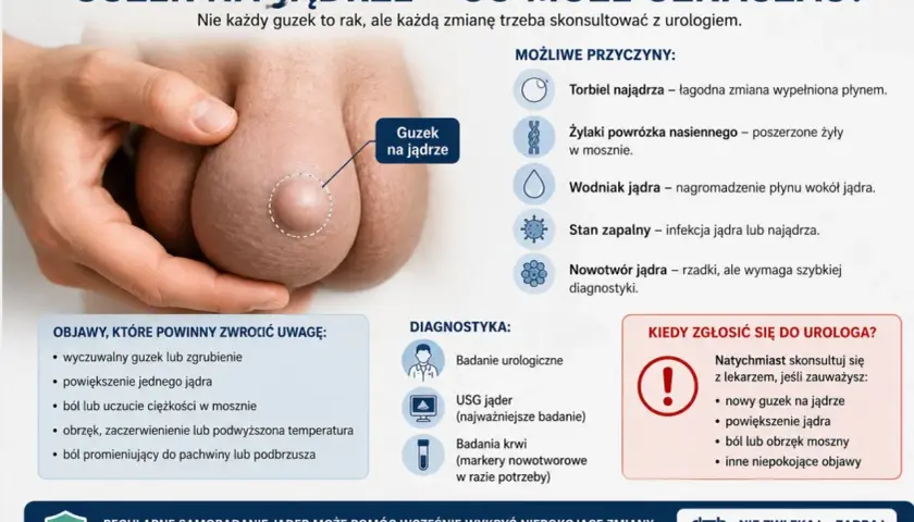 Guzek na jądrze może oznaczać różne rzeczy, w tym nowotwór jądra. Obraz pokazuje guzek na jądrze i wymienia objawy, przyczyny i diagnostykę.