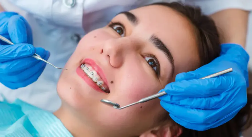 Młoda kobieta z aparatem ortodontycznym na zębach podczas wizyty u ortodonty. Dentysta w niebieskich rękawiczkach bada jej uśmiech.