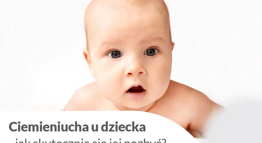 Urocze niemowlę z zaciekawioną miną. Tekst informuje o ciemieniuchy u dziecka i sposobach jej usuwania.