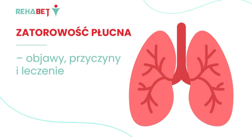 Zatorowość płucna: objawy, przyczyny i leczenie. Grafika przedstawia stylizowane płuca.