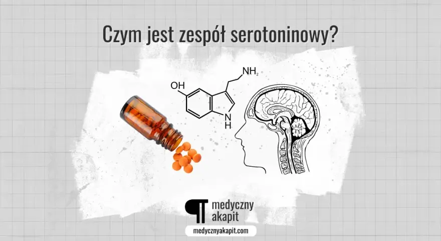 Związek chemiczny serotoniny, mózg i tabletki. Obrazek ilustruje brak serotoniny objawy i zespół serotoninowy.