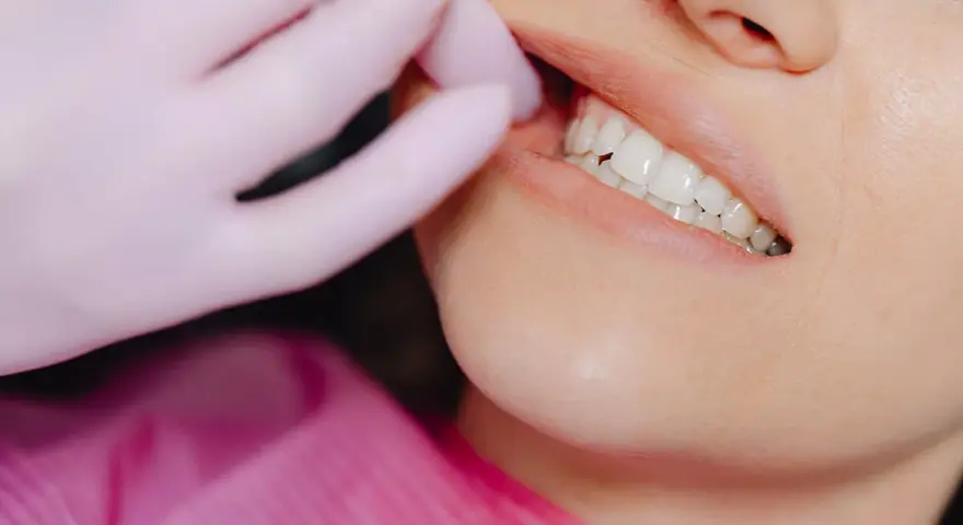 Ruszający się ząb stały? Nie wyrywaj! Pilna pomoc dentysty