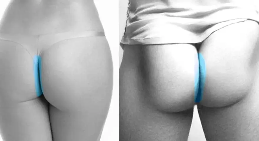 Dos imágenes comparan la depilación anal, una con ropa interior y otra sin ella, resaltando la zona con azul.