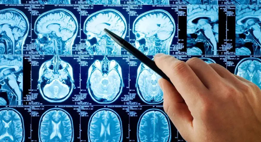 Jakie choroby psychiczne wykryje rezonans magnetyczny głowy i jak to działa