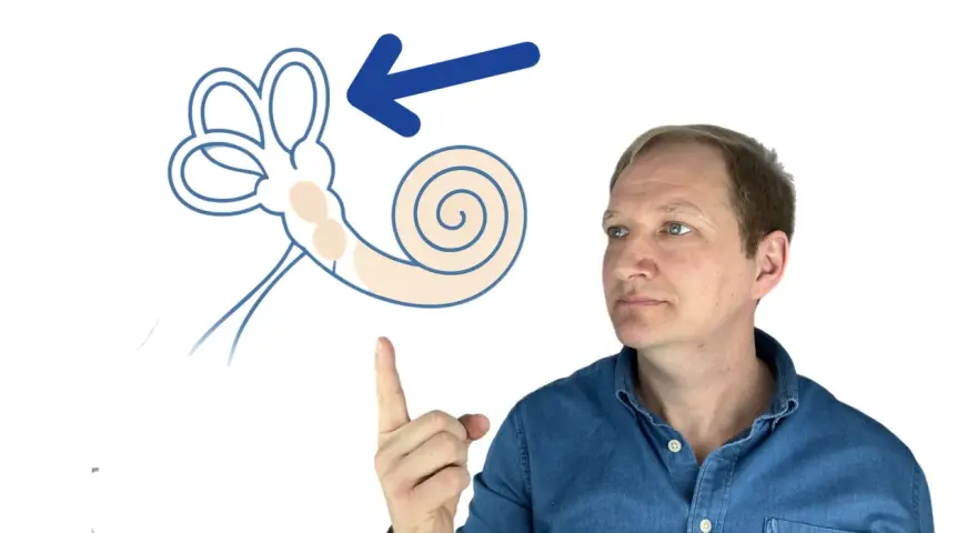 Mann zeigt auf schematische Darstellung des Innenohrs mit Pfeil.