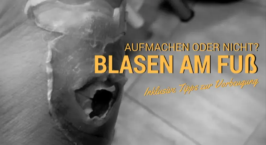 Nahaufnahme eines Fußes mit einer großen, offenen Blase. Text: "Aufmachen oder nicht? Blasen am Fuß. Inklusive Tipps zur Vorbeugung.