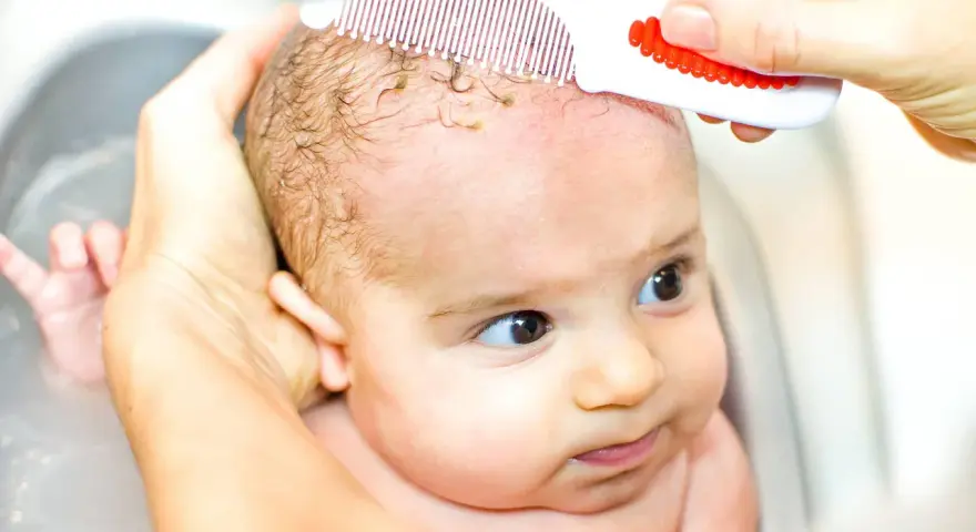 Mani delicate rimuovono la crosta lattea dal cuoio capelluto di un neonato con un pettinino bianco e rosso.