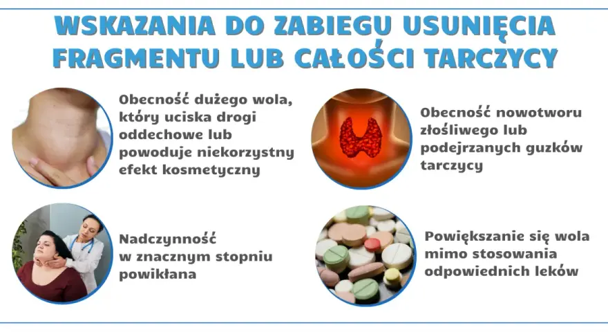 Ilustracja przedstawia schemat tarczycy, powiększone wole, lekarza badającego pacjentkę i tabletki.