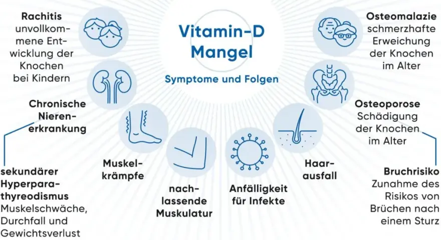 Vitamin D3 1000 I.E.: So schützen Sie sich vor Mangelerscheinungen