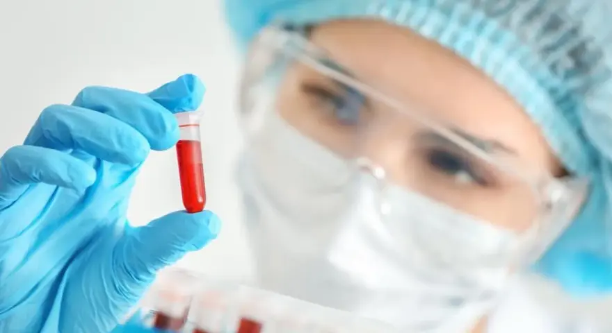 W laboratorium mikrobiologicznym analizuje się próbki, jak ta z krwią, by wykryć i badać mikroorganizmy.