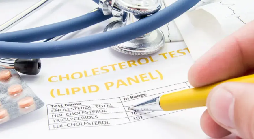 Wynik badania cholesterolu, stetoskop i tabletki. Dowiedz się, jak zbadać cholesterol.