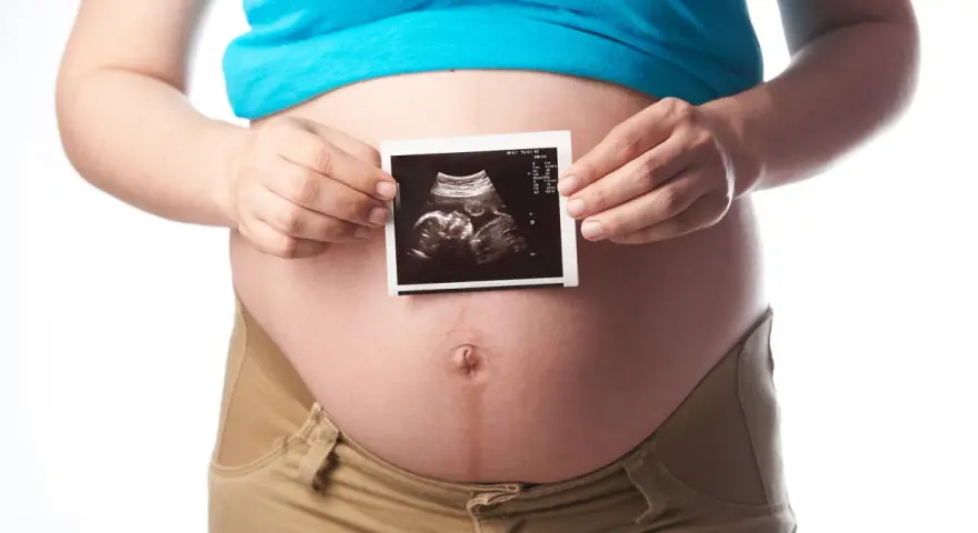 Schwanger in der 21. SSW: Ein Ultraschallbild zeigt das Baby.