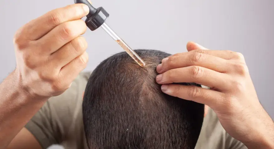 Mężczyzna aplikuje serum na skórę głowy, walcząc z przetłuszczającą się skórą głowy i problemami z włosami.