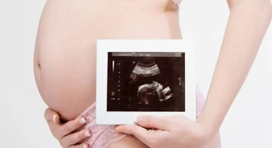Ciężarna kobieta trzyma zdjęcie USG. To badanie, które pokazuje, co oznacza rozwój dziecka.