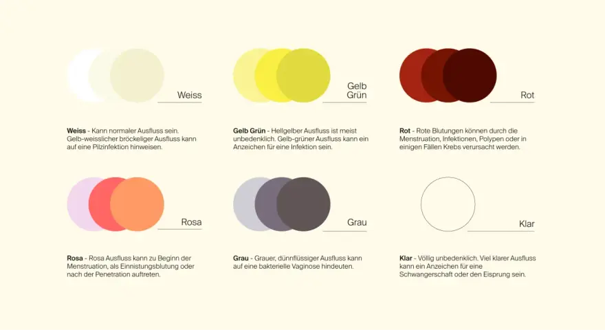 Farbtafel zeigt verschiedene Ausflussfarben: weiß, gelb-grün, rot, rosa, grau und klar. Grauer, dünnflüssiger Ausfluss kann auf eine bakterielle Vaginose hindeuten, manchmal auch schleimiger Ausfluss.