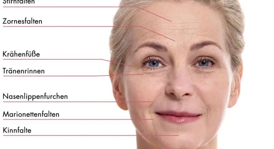 Nahaufnahme einer Frau mit Stirnfalten, Zornesfalten und Krähenfüßen. Selbst mit 20 Jahren können erste Zeichen der Hautalterung sichtbar werden.