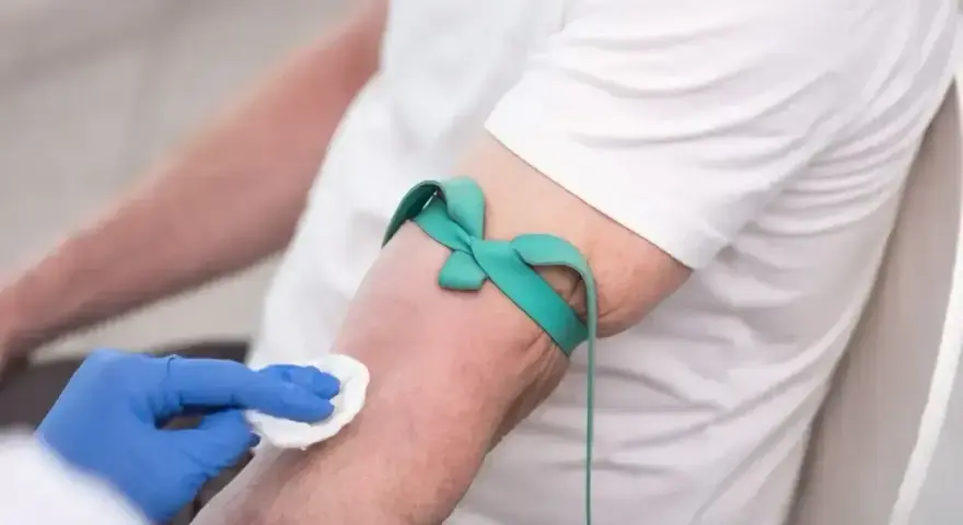 Ręka pacjenta z opaską uciskową i wacikiem przygotowywana do pobrania krwi na badanie HBs antygen.
