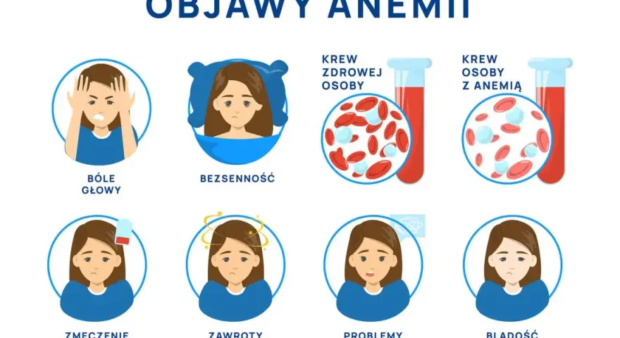 Anemia objawy psychiczne: jak niedokrwistość wpływa na twoje samopoczucie