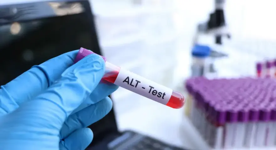 Ręka w niebieskiej rękawiczce trzyma probówkę z krwią oznaczoną "ALT - Test". W tle mikroskop i stojak z próbkami. To badanie ALT.