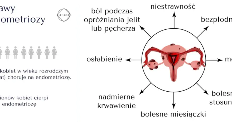 Objawy endometriozy: ból, osłabienie, mdłości, bezpłodność, niestrawność, nadmierne krwawienie, bolesne miesiączki i stosunki. 1 na 10 kobiet choruje.