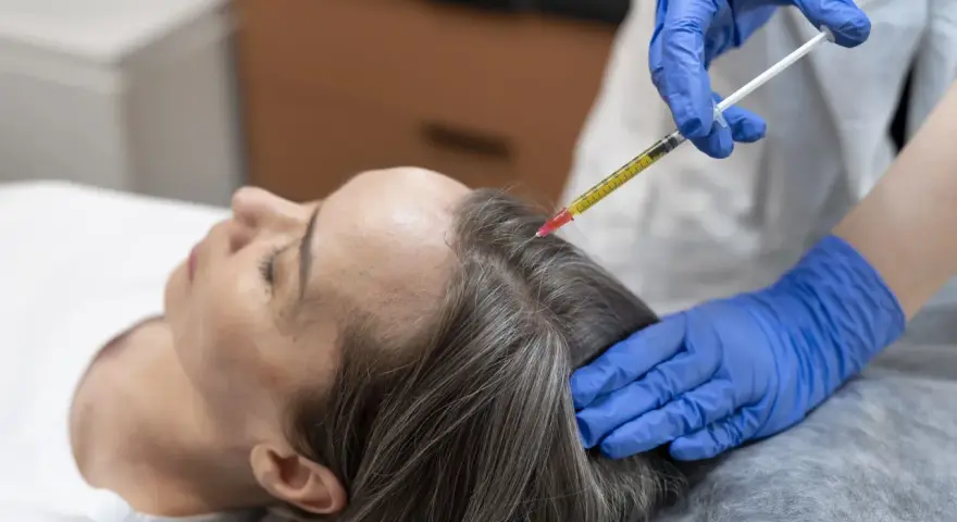 Una mano con guante azul aplica una inyección en el cuero cabelludo de una mujer, buscando aliviar el dolor y estimular el crecimiento del cabello.