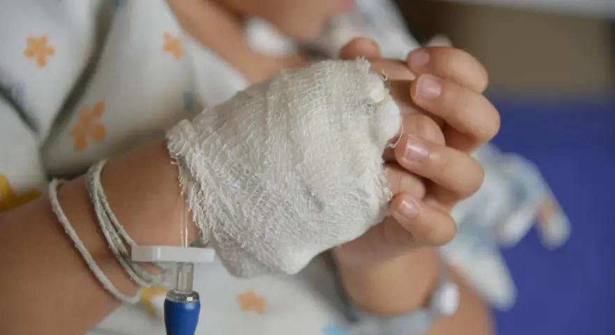 Dziecko z wenflonem w dłoni. Obrazek ilustruje, co to za choroba, jaką jest błonica, i jej leczenie.