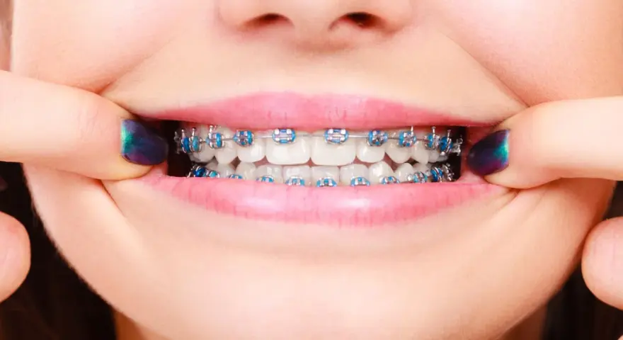 Czy ortodonta to dentysta? Poznaj kluczowe różnice i wybierz specjalistę