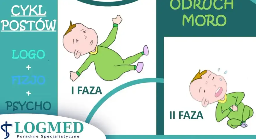 Ilustracja przedstawia dwie fazy odruchu Moro u niemowląt: pierwszą, gdzie dziecko jest wyciągnięte, i drugą, gdzie płacze.