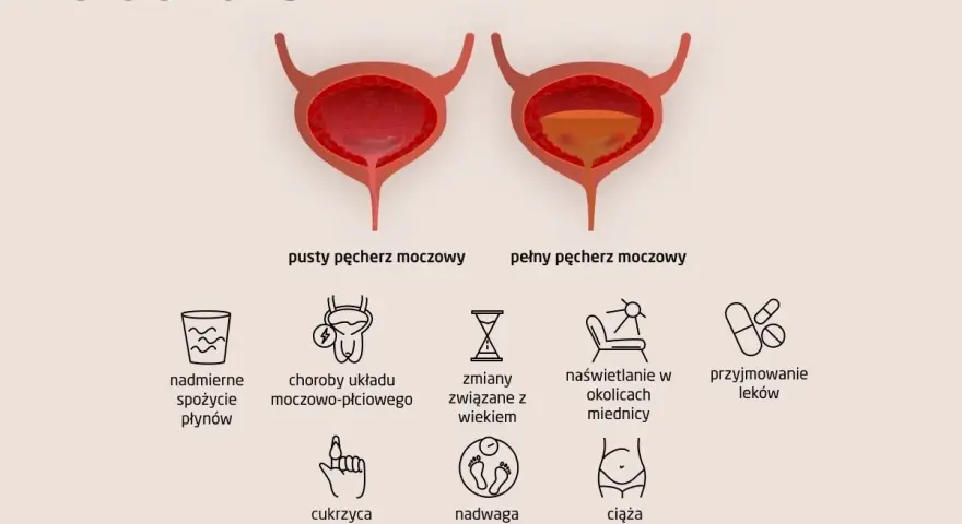 Ilustracja pokazuje przyczyny częstego oddawania moczu: nadmierne picie, choroby, wiek, nadwagę, ciążę i leki.