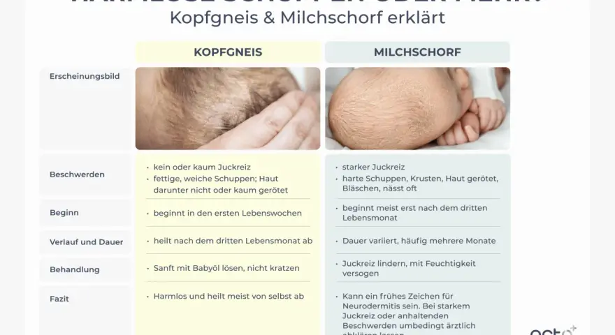 Baby kratzt sich am Kopf wegen Kopfgneis oder Milchschorf. Die Bilder zeigen die Unterschiede.