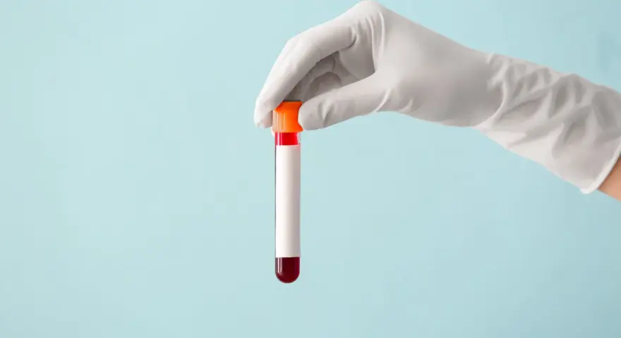 Ręka w białej rękawiczce trzyma probówkę z czerwoną próbką krwi, gotową do analizy, która może wykazać poziom immunoglobuliny.