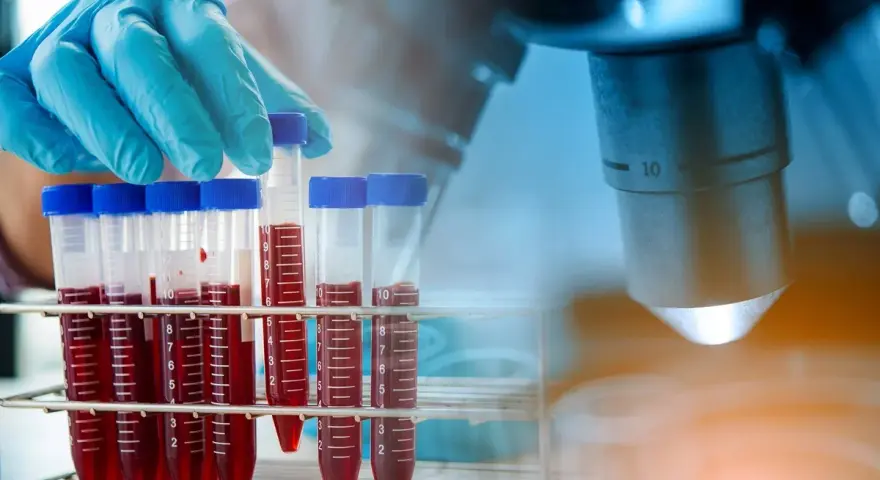 Rękawiczka laboratoryjna trzyma probówkę z krwią na tle mikroskopu.