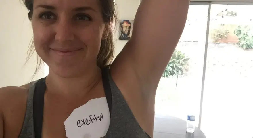 Kvinna visar sin armhåla, som har viss hyperpigmentering. En lapp med texten "eveftw" sitter på hennes bröst.