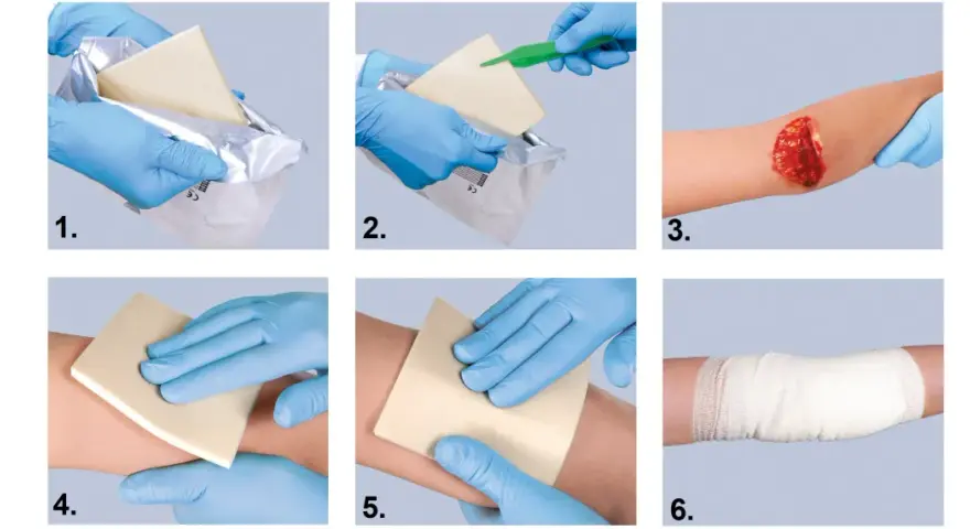 Instrukcja: opatrunek hemostatyczny jak używać. Wyjmij, przygotuj, przyłóż do rany, dociśnij, zabezpiecz bandażem.