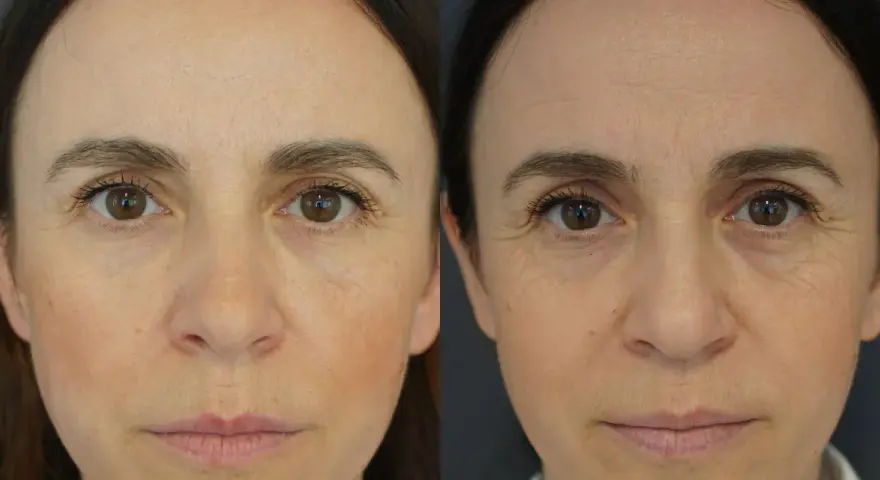 Nahaufnahme zweier Gesichter, die die Entwicklung von reifer Haut ab wann zeigen. Falten um die Augen und auf der Stirn sind sichtbar.