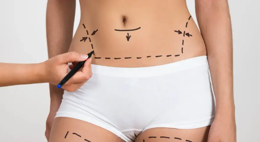 Liposukcja kawitacyjna - kiedy zobaczysz efekty zabiegu?