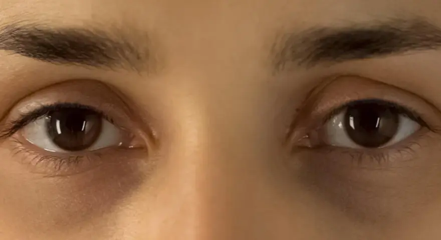 Nahaufnahme von Augen mit dunklen Ringen unter den Augen.