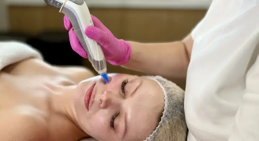 Zabieg dermapen na twarzy kobiety w ciąży, wykonywany przez kosmetyczkę w różowych rękawiczkach.