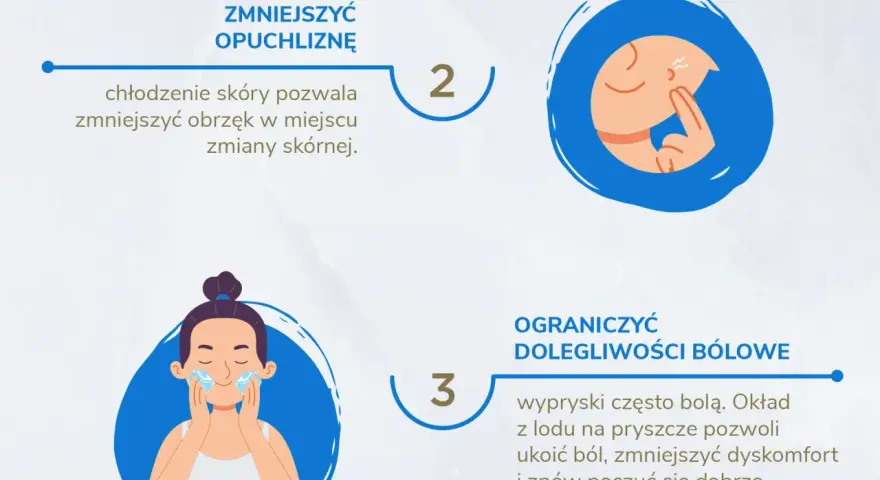 Lód na pryszcze: czy działa? Poznaj fakty i jak stosować