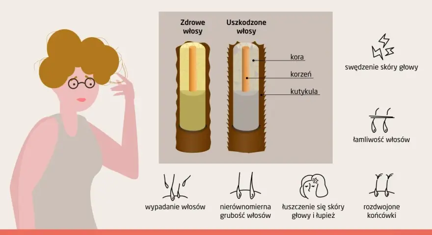 Ilustracja pokazuje objawy suchych i łamliwych włosów, w tym rozdwojone końcówki i ogólne osłabienie struktury włosa.