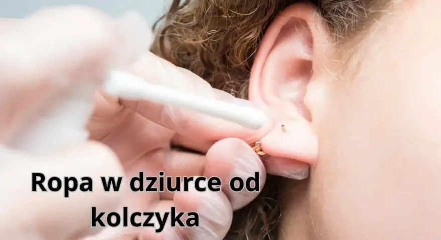 Ropa w dziurce od kolczyka. Wacik kosmetyczny usuwa wydzielinę z ucha po przekłuciu.