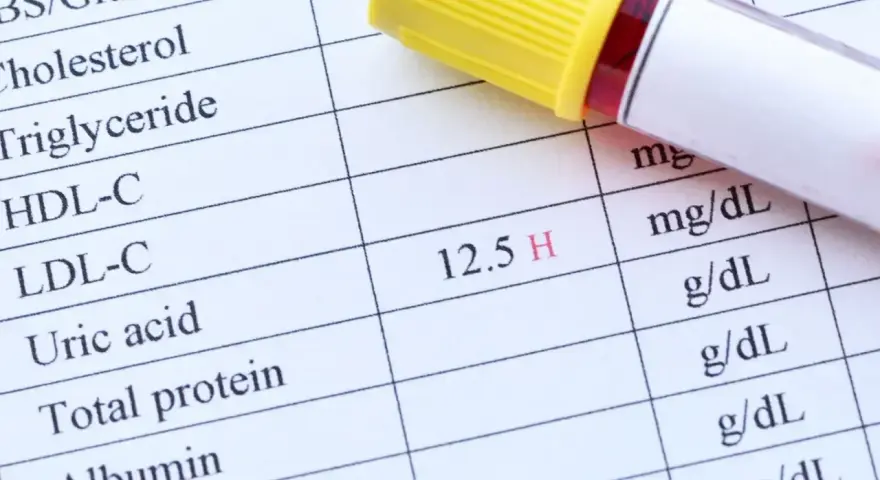 Wynik badania krwi pokazuje podwyższony poziom kwasu moczowego (12.5 H). Obok leży probówka z krwią.