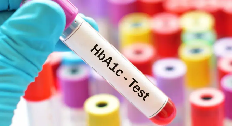 Ręka w niebieskiej rękawiczce trzyma probówkę z napisem "HbA1c - Test". W tle kolorowe probówki. Sprawdź, jaka jest hemoglobina glikowana cena.