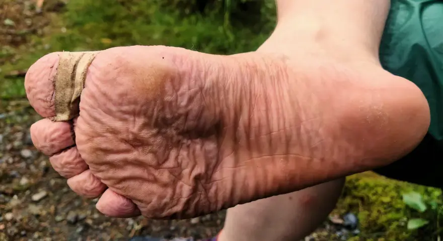 Fuß mit Blasenpflaster am Zeh, um Blasen vorzubeugen. Die Haut ist zerknittert vom Wandern.