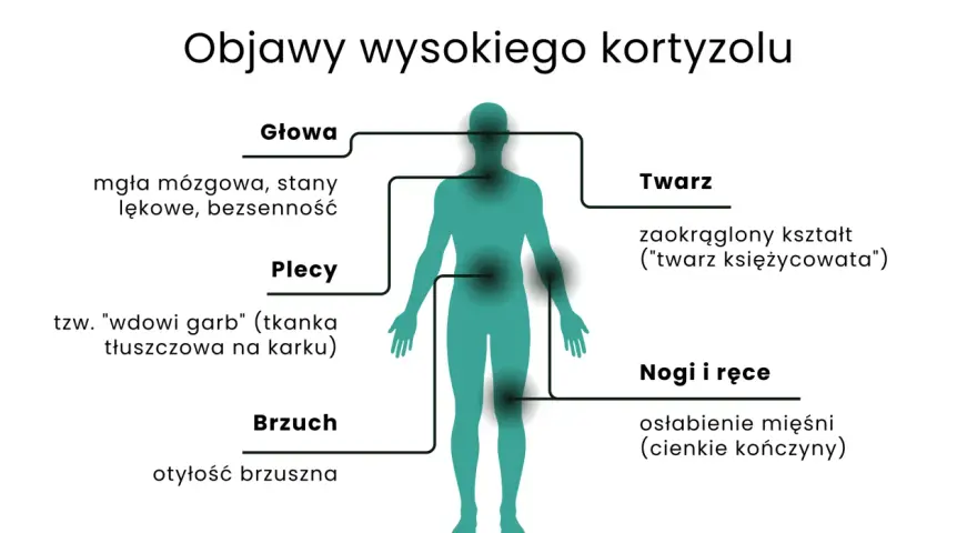 Ilustracja przedstawia sylwetkę człowieka z zaznaczonymi obszarami ciała i objawami wysokiego kortyzolu.