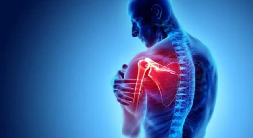 Anatomie d'un homme montrant une douleur vive à l'arrière de l'épaule, mise en évidence par une zone rouge intense.
